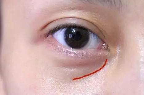 沈陽哪家醫(yī)院做雙眼皮好？推薦這幾家，讓你的雙眼美麗動人起來！