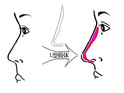 深圳最佳激光脫毛整形醫(yī)院推薦-公立醫(yī)院領(lǐng)跑市場！