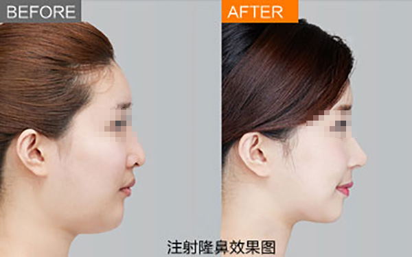 鄭州唇部整形醫(yī)院推薦：如何選擇合適的醫(yī)院？友友必看！