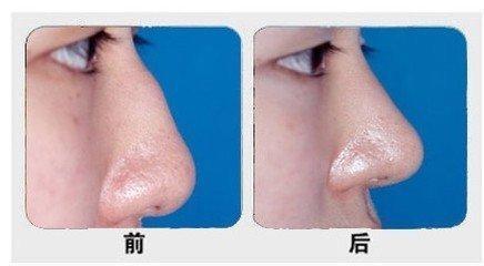 石家莊主要公立整形醫(yī)院排行榜！公辦醫(yī)療機(jī)構(gòu)最具實(shí)力！