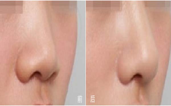 福建五所知名整形醫(yī)院盛世薈萃：瑞麗、愛(ài)思特、雅美等品牌強(qiáng)勢(shì)入圍！
