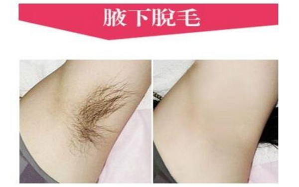聚焦常州激光醫(yī)院效果盤點：美麗年輕無止境！
