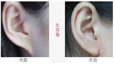 2023沈陽去魚尾紋雕塑醫(yī)院排行榜，這十家都備受口碑推崇！
