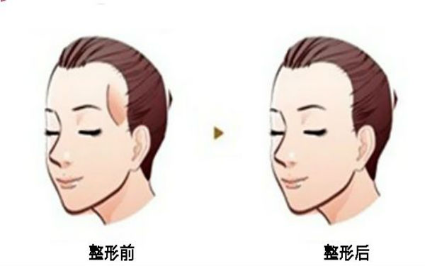 西寧顴骨矯正術(shù)：哪家醫(yī)院口碑好？2023年口碑排名前10的正規(guī)醫(yī)療整形醫(yī)院公布！
