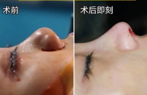 南京最熱門的環(huán)形精雕吸脂醫(yī)療美容醫(yī)院綜合推薦！2023年排行前十名大揭曉！