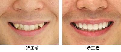 高性價(jià)比的滁州曼托水滴型假體隆胸整形醫(yī)院推薦！2023年滁州曼托水滴型假體隆胸醫(yī)院TOP10口碑排行，實(shí)力醫(yī)