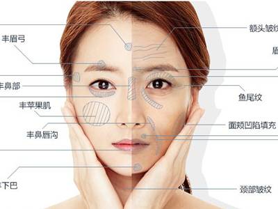 廣州臉部打溶脂針排名前10的美容醫(yī)院口碑大揭秘！2023年很受好評(píng)的整形醫(yī)院技術(shù)盤(pán)點(diǎn)！
