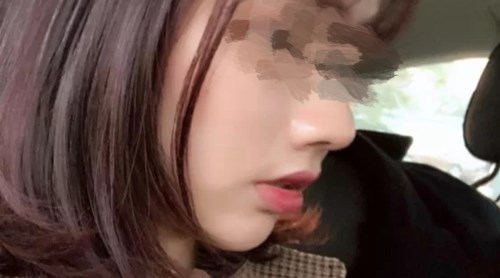 貴陽有哪些專業(yè)的磨皮去痘印醫(yī)院？2023年TOP10推薦實(shí)力醫(yī)院揭曉