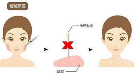 2023武漢隆胸材料取出醫(yī)院排行榜發(fā)布！武漢哪家整形醫(yī)院的推薦度高？