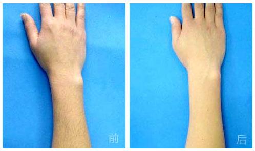杭州哪家整形美容醫(yī)院能有效避免眼部皺紋？2023年杭州眼部皺紋美容醫(yī)院前十位排行榜來(lái)啦！