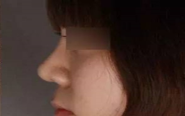 重慶哪家整形醫(yī)院祛黑眼圈效果靠譜？2023年重慶祛黑眼圈醫(yī)療機(jī)構(gòu)排名前十值得信賴(lài)嗎？