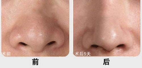 漳州有哪些性價比高的雙眼皮微創(chuàng)抽脂醫(yī)院？2023年漳州雙眼皮微創(chuàng)抽脂醫(yī)院排名前十更新！