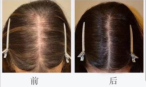廣州哪些醫(yī)院可靠，專業(yè)進行臉部疤痕切除整形美容？2023年十大排名公開！