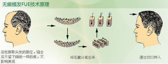 2023青島眼袋修復(fù)手術(shù)排名前10的信譽(yù)醫(yī)院！