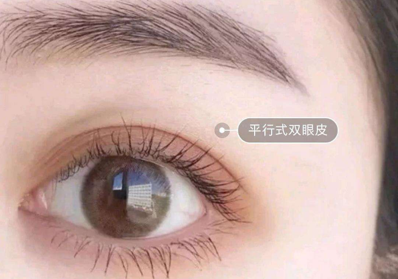 鄭州最受推崇的雙眼皮整形專家推薦榜單露臉！多位實(shí)力經(jīng)驗(yàn)高手霸占榜首！