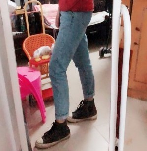 胖腿女孩兒福利分享：吸脂瘦大腿的蛻變，效果值得點(diǎn)贊！