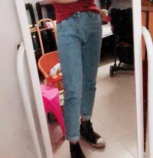 胖腿女孩兒福利分享：吸脂瘦大腿的蛻變，效果值得點贊！