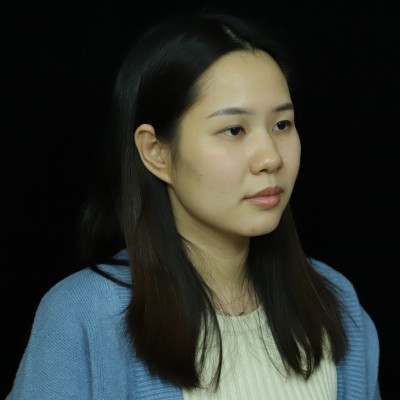 記錄我在廣州韓妃整形美容醫(yī)院眼綜合的手術經(jīng)歷，還有前后對比照片~