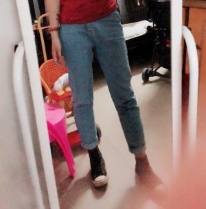 胖腿女孩兒福利分享：吸脂瘦大腿的蛻變，效果值得點(diǎn)贊！
