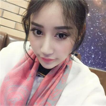 雙眼皮失敗丑的不敢見人，昆明麗都整形雙眼皮修復(fù)案例分享