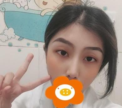 救命，周杰群做的耳軟骨隆鼻恢復后鼻背線條也太好看了吧