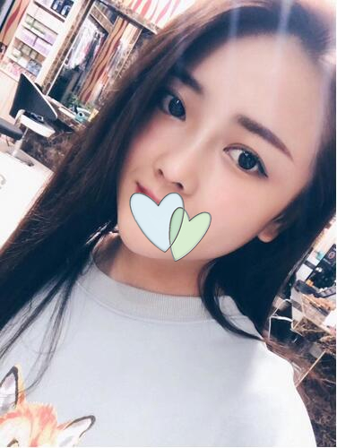 廈門海峽整形鼻綜合案例分享，這鼻子可以滑滑梯了