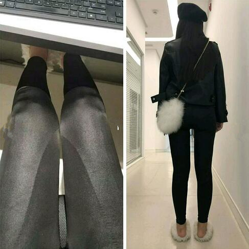 4800做的大腿吸脂，效果竟然還不錯