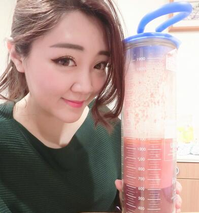 揭陽美萊整形手臂吸脂案例分享，輕松告別拜拜肉