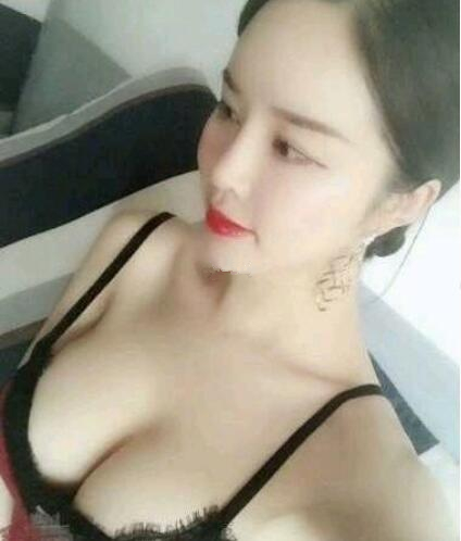 濟南海峽整形假體隆胸術后一個月