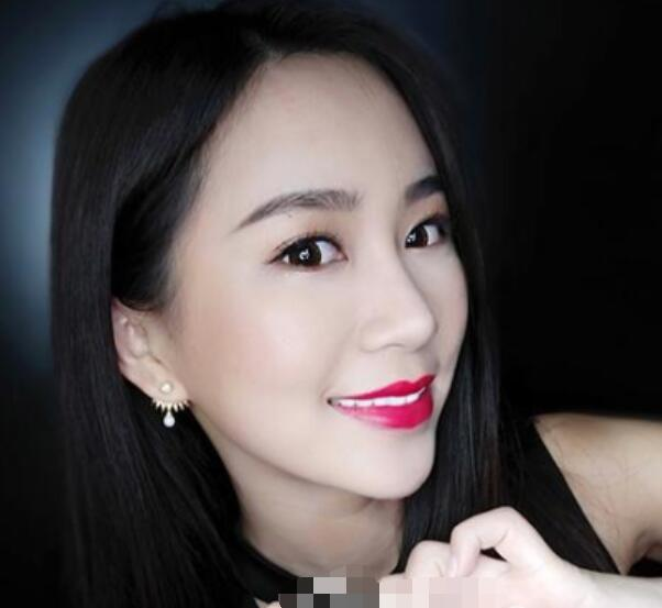 深圳鵬程整形劉冰做的鼻子真絕了，跟我想象的一模一樣