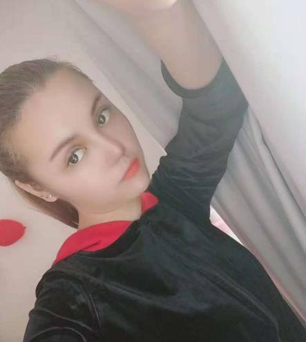 長沙雅美眼鼻整形案例分享，術后這滿滿的混血感是腫么回事