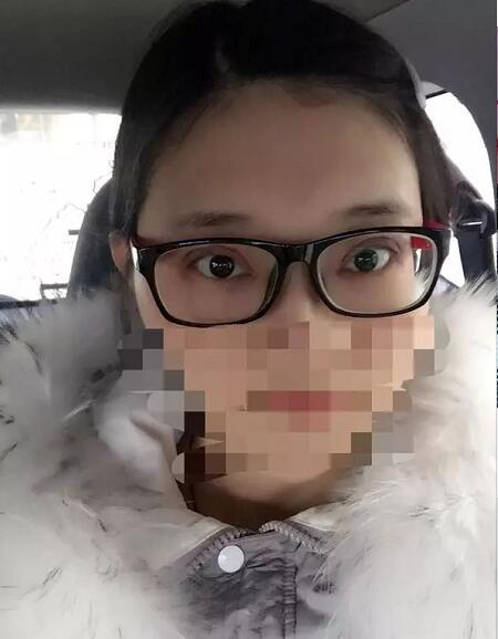 北京京民雙眼皮修復(fù)案例分享，說(shuō)是媽生眼我都信
