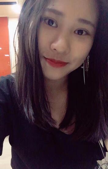 肇慶華美整形切開雙眼皮術(shù)后三個(gè)月