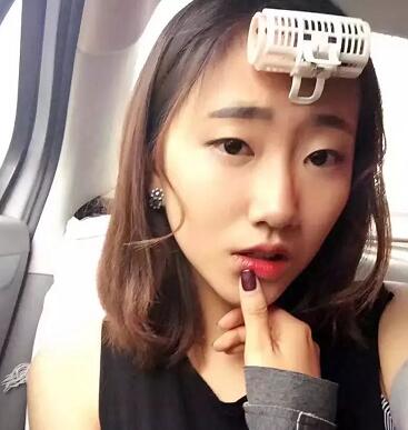 武漢藝星整形岳金堂醫(yī)生雙眼皮案例術前效果