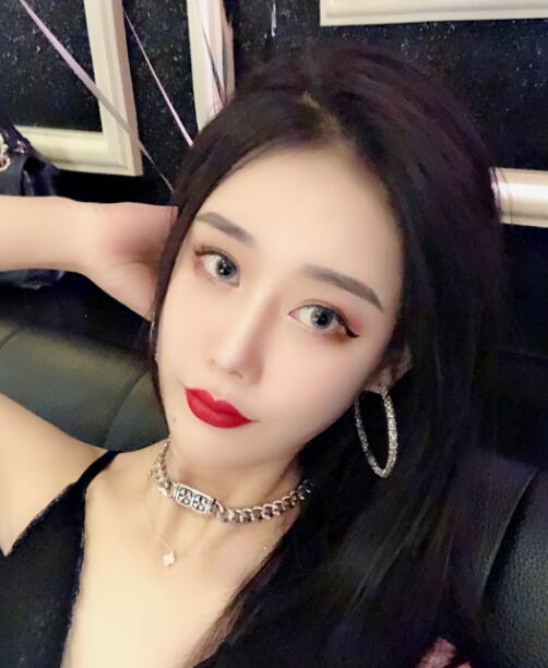 長沙亞韓整形陳明松下頜角整形術后三個月效果