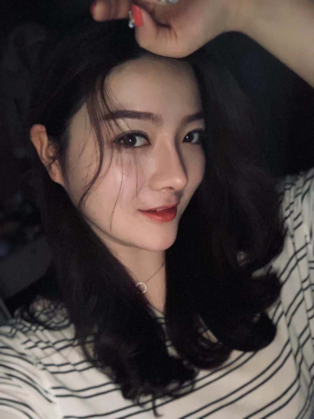 北京圣嘉榮二次鼻修復術后一個月