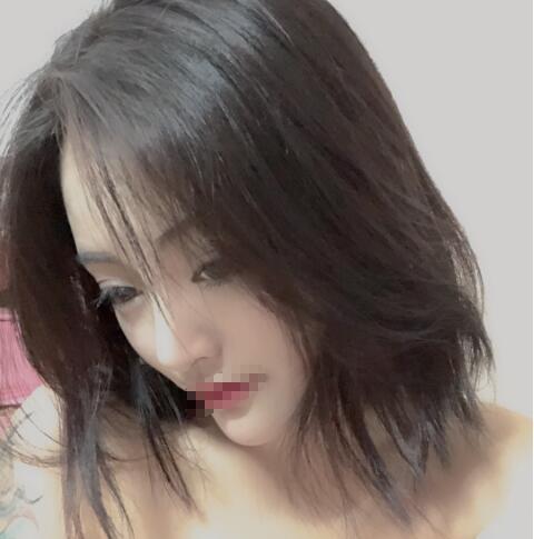 上海賽美瑞整形張化舉鼻綜合一個月效果