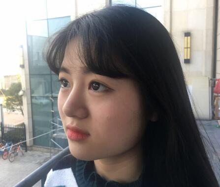 西安希美得整形瘦臉針瘦臉半個月效果反饋