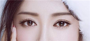 貴陽美和諧醫(yī)療美容門診部做雙眼皮術(shù)后效果
