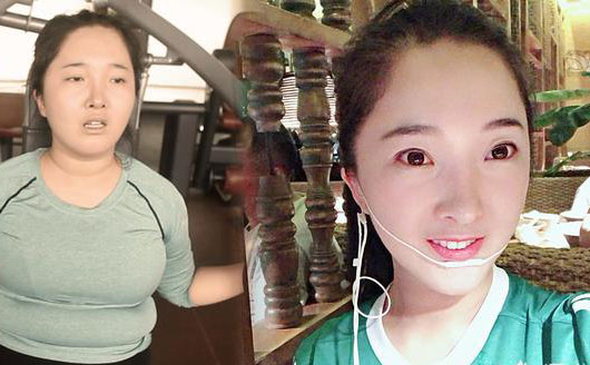 埋線減肥是什么？中醫(yī)診所里推出的埋線減肥真有用嗎，有科學依據(jù)嗎？