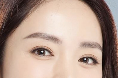 懷化致臻美悅時(shí)尚醫(yī)療美容診所開(kāi)內(nèi)眼角