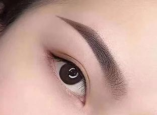 昆山百達麗醫(yī)療美容門診部開內(nèi)眼角術(shù)后效果