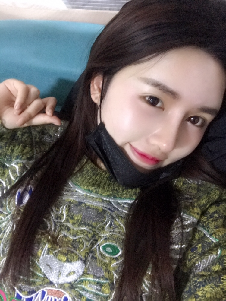 北京星美李寧輝進(jìn)口膨體隆鼻案例效果對比圖，鼻子自然又美麗