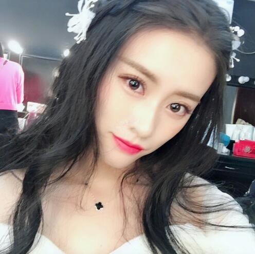 長春銘妍醫(yī)療美容門診部做雙眼皮怎么樣？長春銘妍雙眼皮案例分享