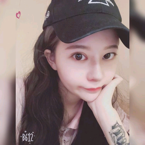 王良發(fā)假體隆鼻案例效果對(duì)比圖
