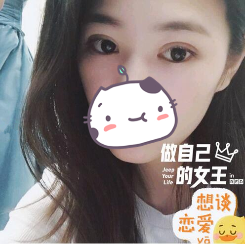 西昌玥美整形專家湯穎峰做雙眼皮怎么樣？湯穎峰雙眼皮案例賞析