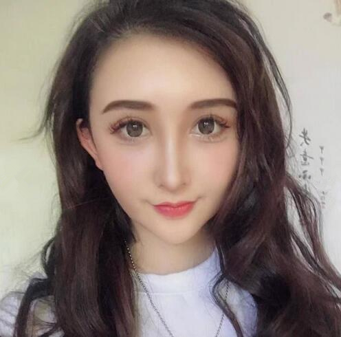 昆明維多利亞整形專家成昌燮做自體脂肪填充效果怎么樣？成昌燮隆鼻案例分享
