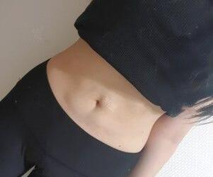廣州星團(tuán)醫(yī)學(xué)整形醫(yī)生顧鵬做腹部吸脂效果怎么樣？顧鵬腹部吸脂案例展示