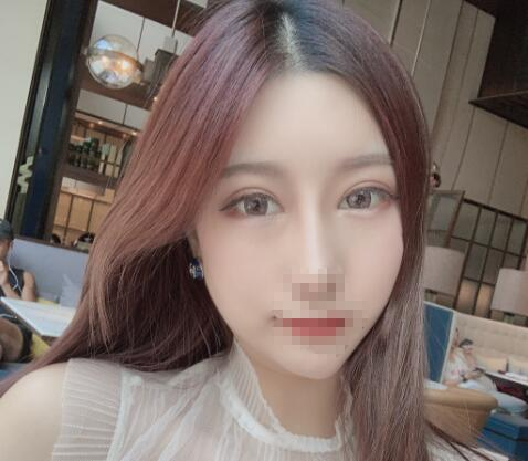 北京彤美整形醫(yī)院專家李長賦做鼻部綜合整形怎么樣？