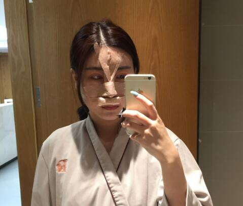 北京彤美整形醫(yī)院專家李長賦做鼻部綜合整形怎么樣？